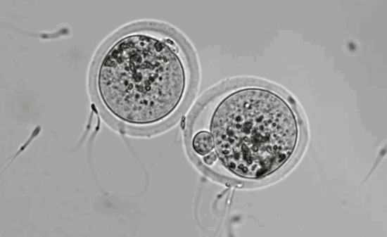 What are the Signs of Ovulation? - needed.